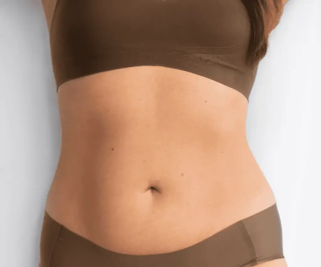 Buikwandcorrectie Buikwandcorrectie