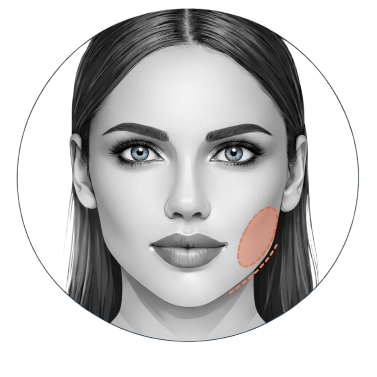 Hyalase Face slimming