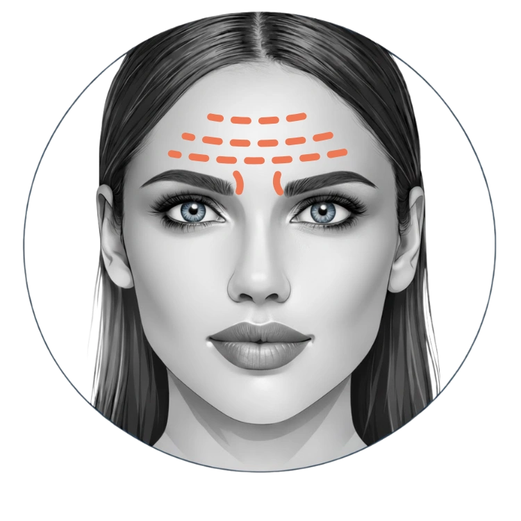 Spierontspanners 2 Migraine behandeling