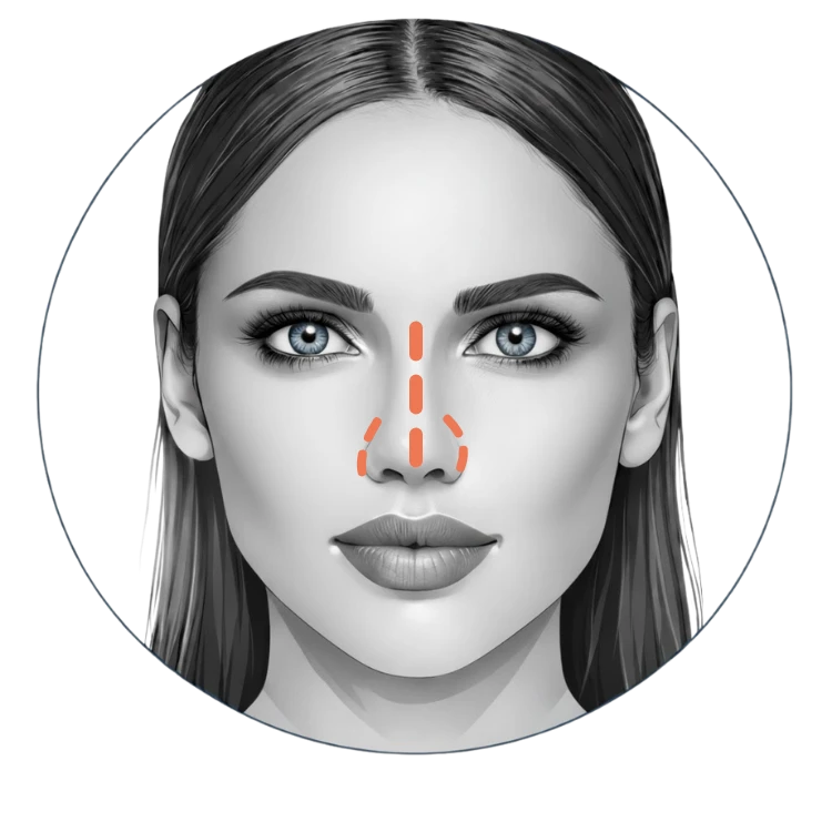 Spierontspanners 3 Neuspuntlift