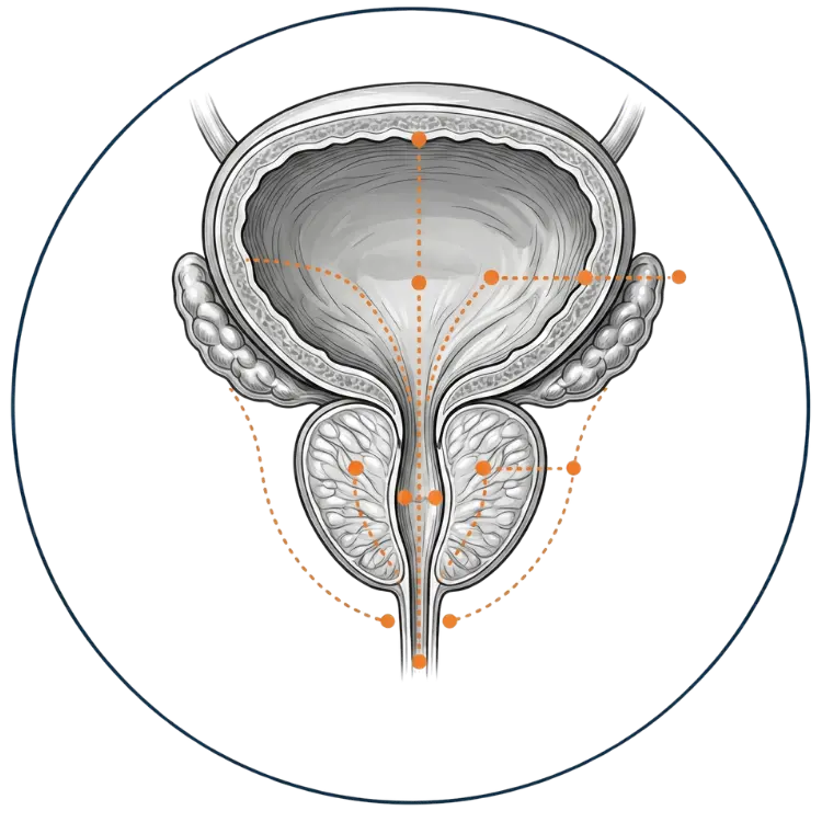 Prostaatklachten (BPH)