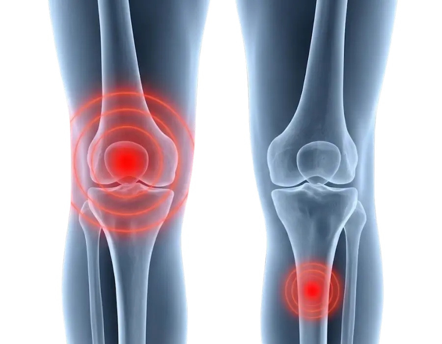 Knie